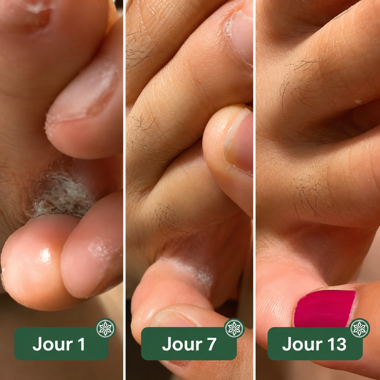 Onela® Savon Antifongique