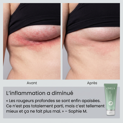 Onela - Crème Apaisante Intertrigo