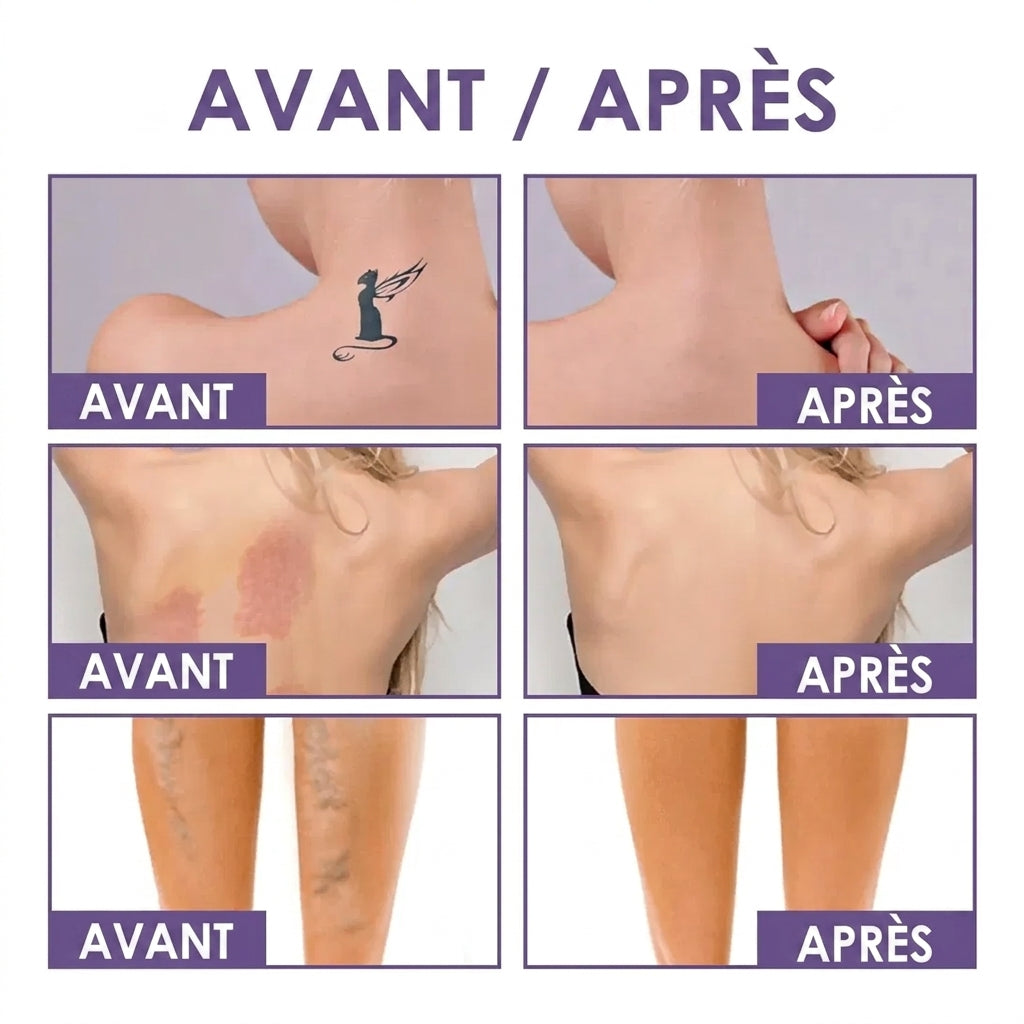 Onela® - Perfecteur de Peau Corps